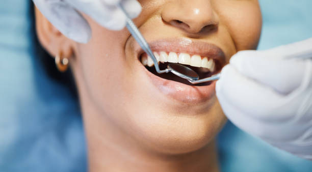 Best Cosmetic Emergency Dentistry in South Highpoint, FL